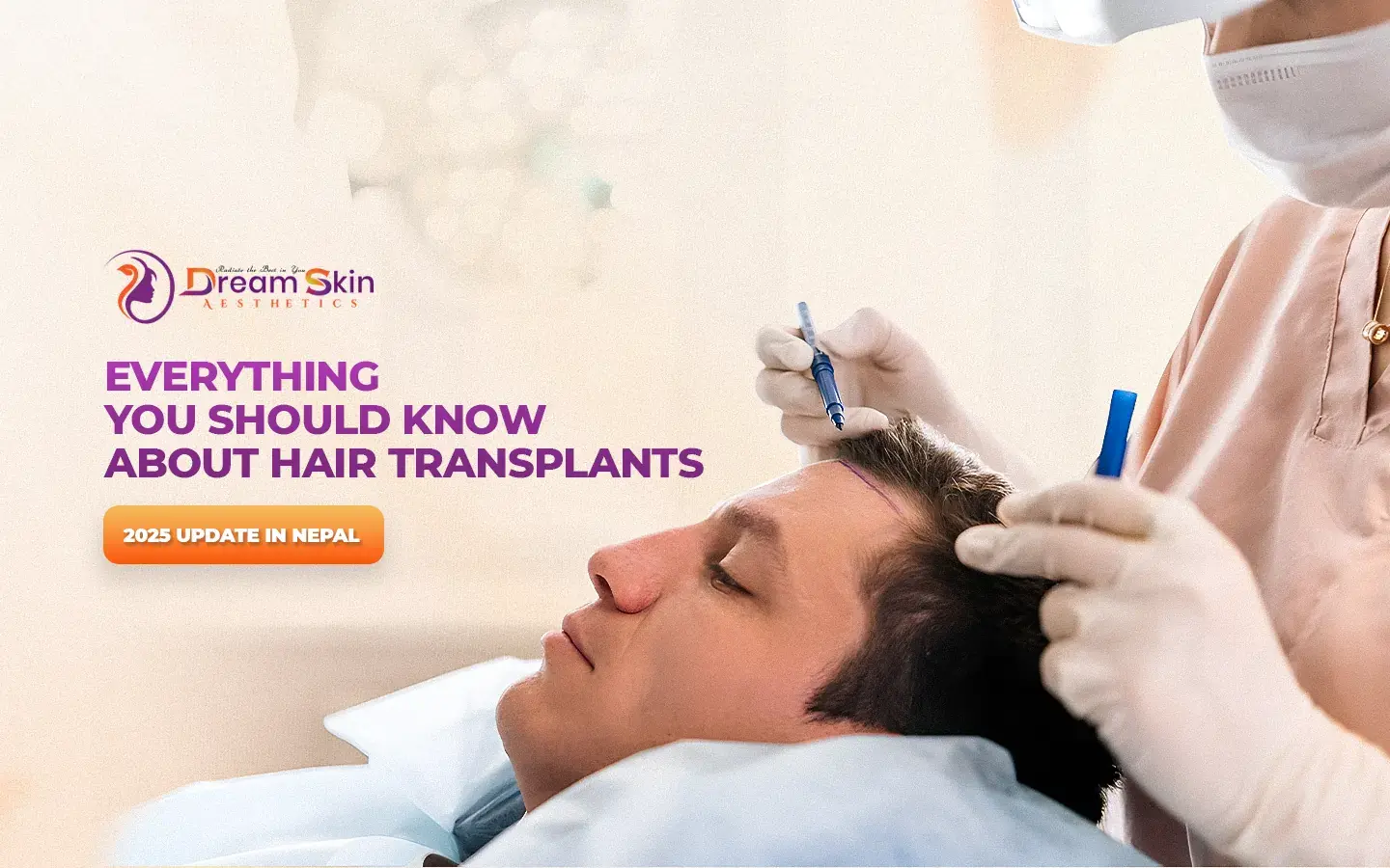 Blog - Everything You Should Know About Hair Transplants in Nepal (2026 Update)