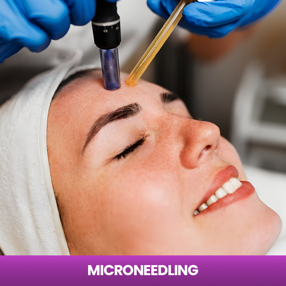 Service - Microneedling